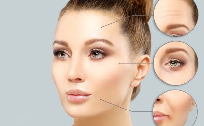 Lipofilling twarzy – bezpieczny sposób na odmłodzenie, dający spektakularny efekt